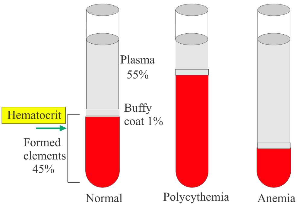 Hematocrit is the percentage of blood composed of RBCs .