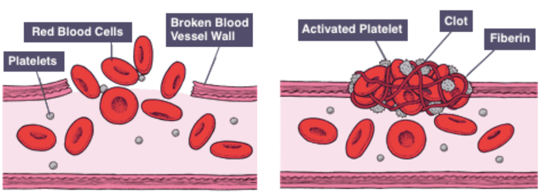 Platelets, also called thrombocytes, are a component of blood whose function is to react to bleeding from blood vessel…