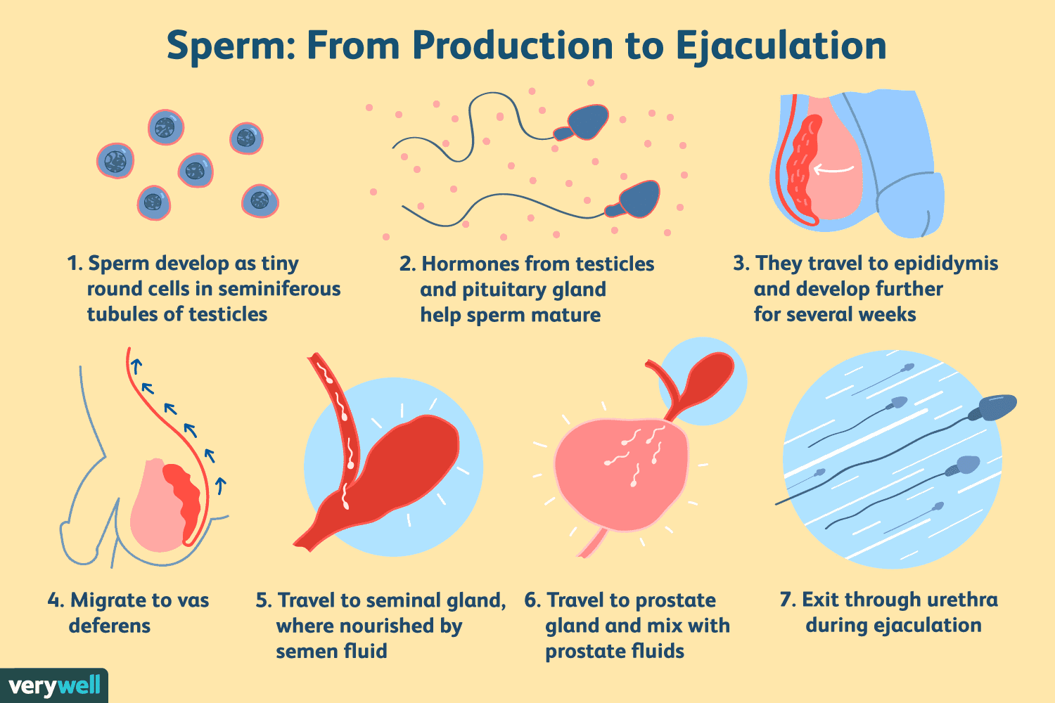 Semen is a combination of sperm and seminal fluid.