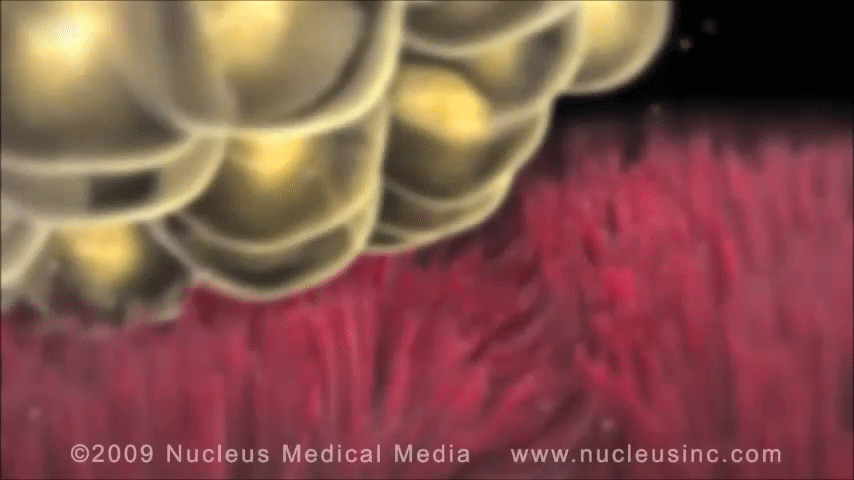 Fallopian tube is lined with cilia.