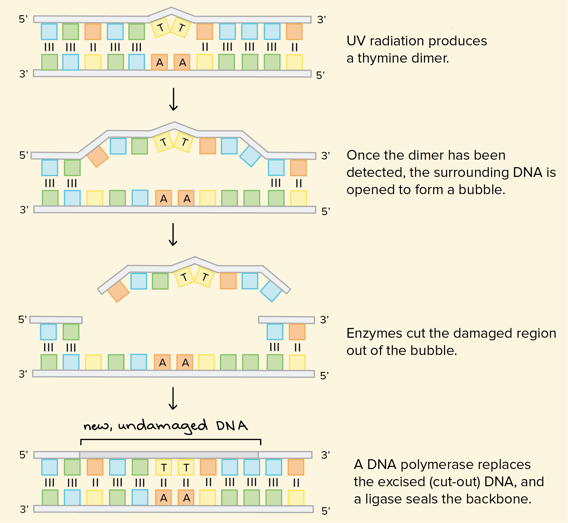Nucleotide excision repair fixes helix-deforming lesions of DNA such as Thymine dimers