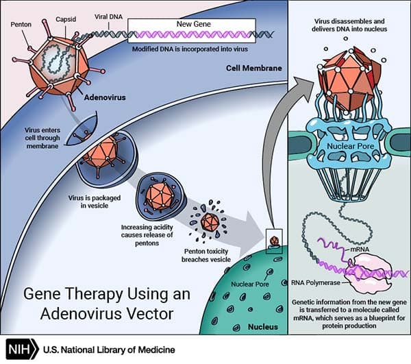 adenovirus: Gene therapy is a method of curing genetic deficiencies by introducing a functional gene with a viral vector.