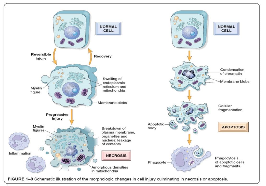 Upon necrosis, contents of cell are released into extracellular environment. True.