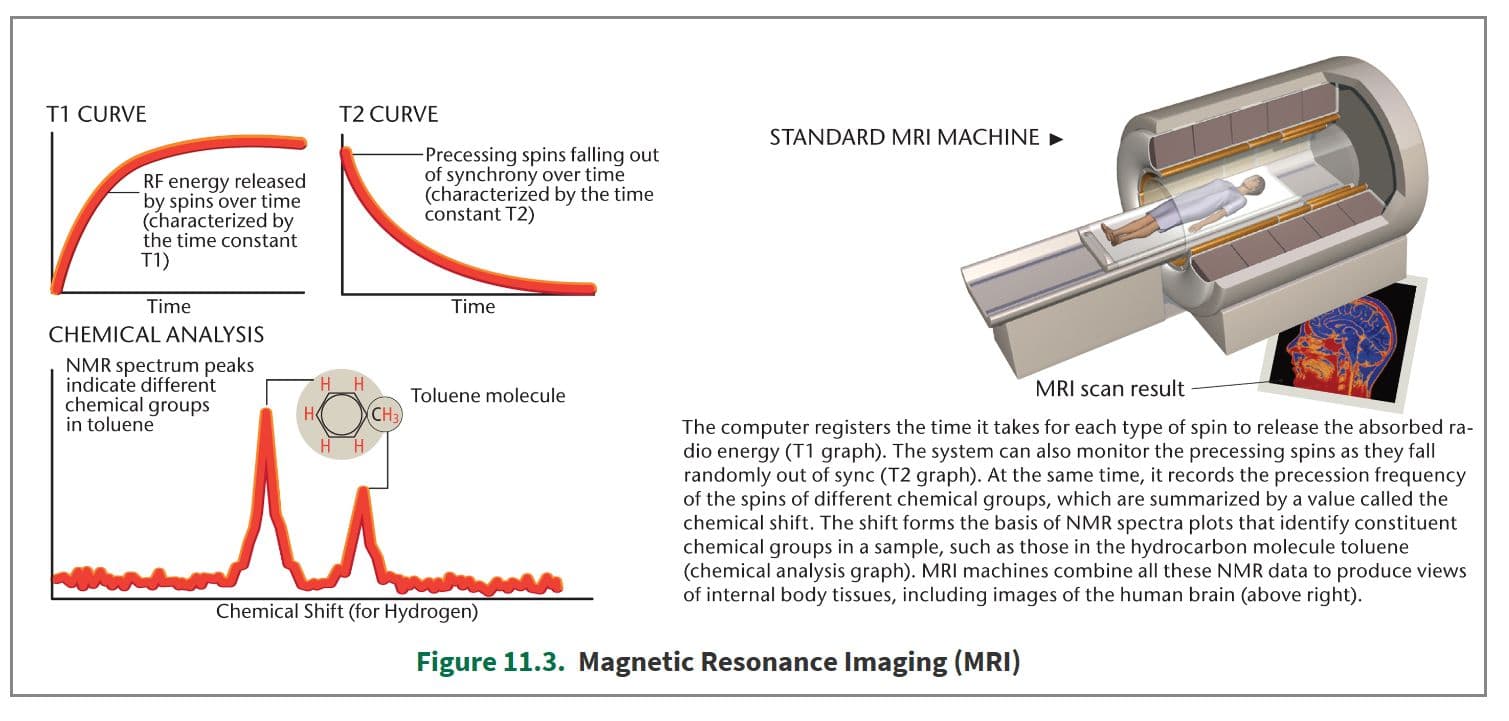In a MRI, various chemical shifts of absorbing protons are translated into specific shades of grey.