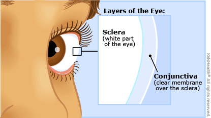 Conjunctiva: The sclera, also known as the white of the eye , is the opaque, fibrous, protective, outer layer of the human eye conta…
