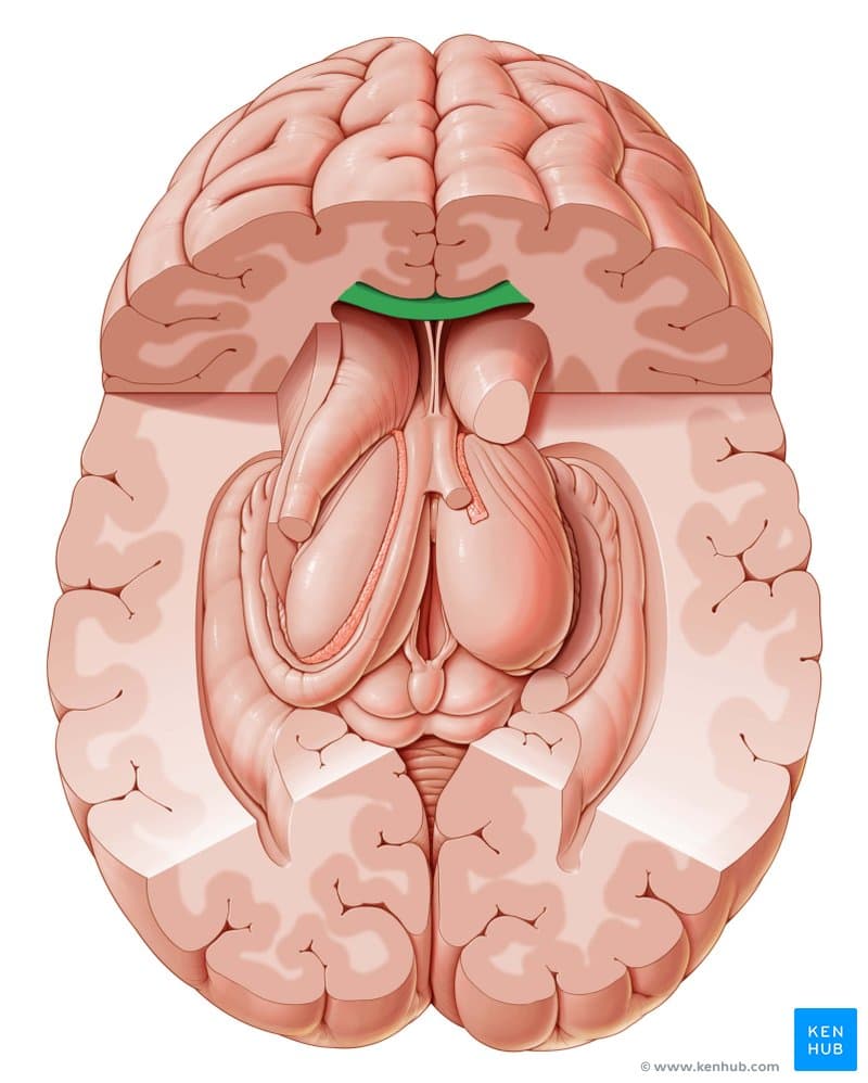 The corpus callosum is a thick band of nerve fibers that divides the cerebral cortex lobes into left and right hemisphe…