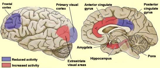 Dreams Illogical: Our dreams sometimes contain visual images that are not logical . This is because activity in the prefrontal cortex is…