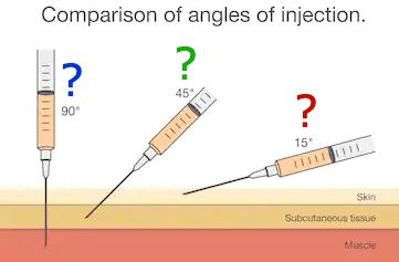 Injection Types Blank: Identify the three injection types shown above ____