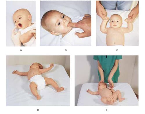 The rooting, moro, babinski, and grasping reflexes are examples of primitive reflexes.