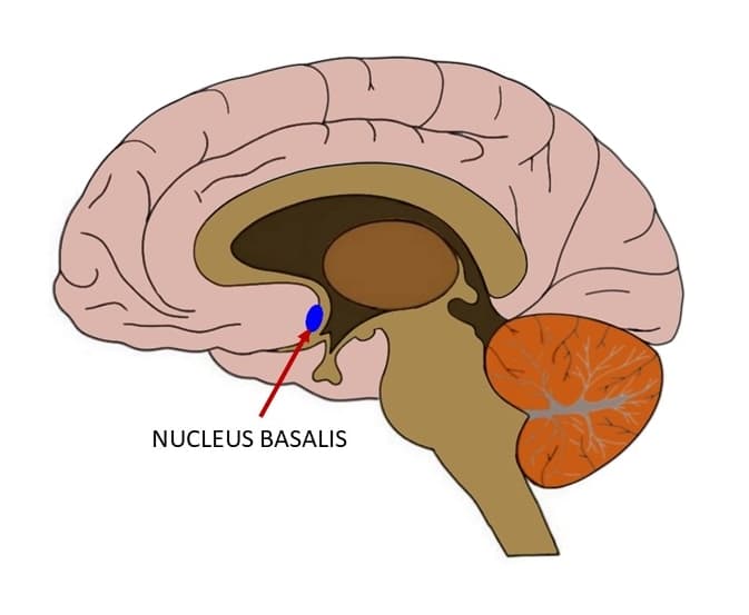People with alzheimer's typically lose the brain region called the nucleus basalis which is important in acetylcholine…