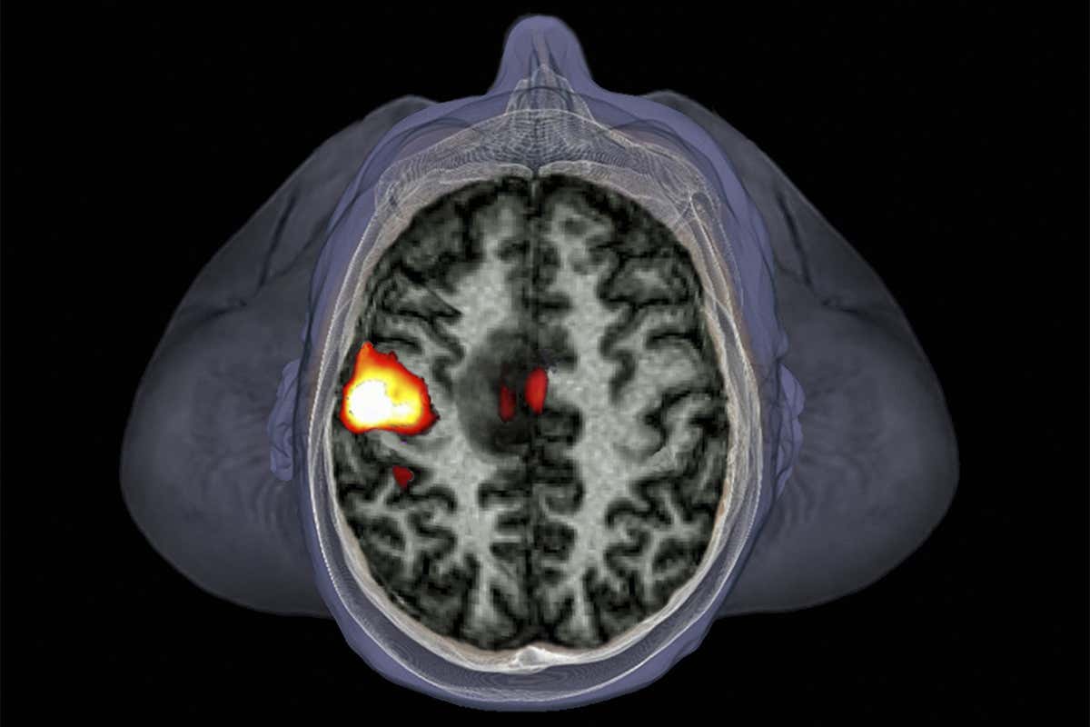 fMRI analyzes amounts of oxygenated vs deoxygenated blood in the brain to figure out what regions are active