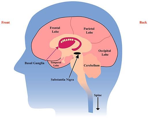 Oxidopamine destroys dopamine and norepinephrine neurons to help model parkinson's disease in lesion studies