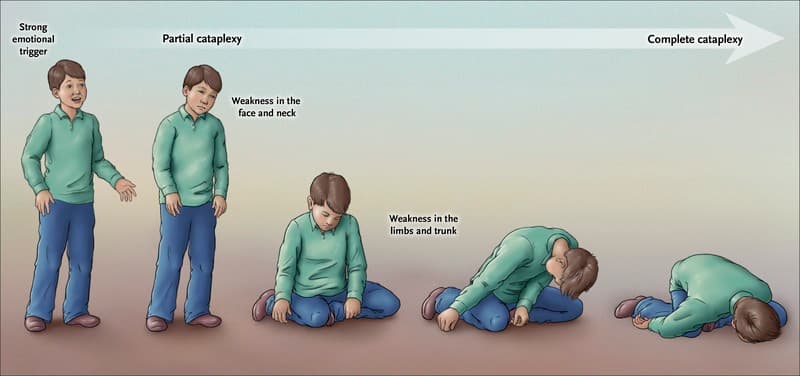 Narcolepsy is when individuals can't help themselves from falling asleep