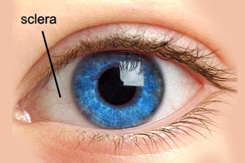 sclera 500x500: The sclera is the white of the eye and made of thick fibrous tissue.