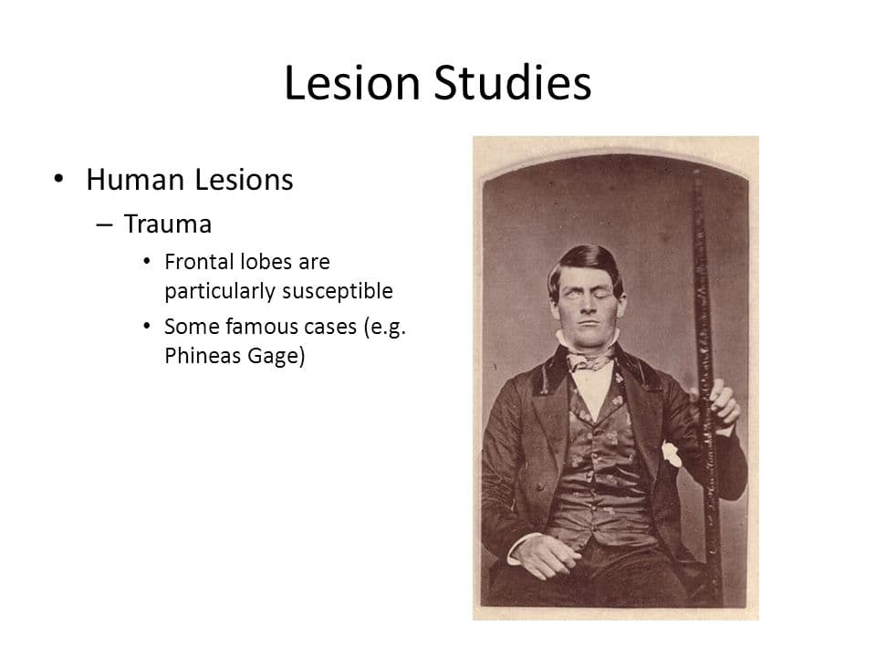 slide 4: Lesion studies involve destroying areas of the brain and then studying the resulting changes in behavior